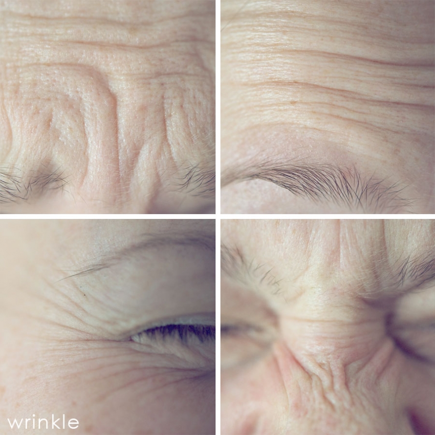 wrinkle